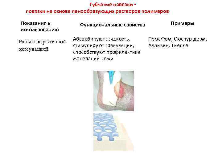Губчатые повязки - повязки на основе пенообразующих растворов полимеров Показания к использованию Раны с