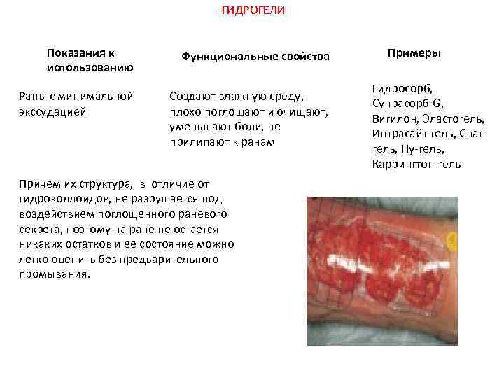 ГИДРОГЕЛИ Показания к использованию Функциональные свойства Раны с минимальной экссудацией Создают влажную среду, плохо