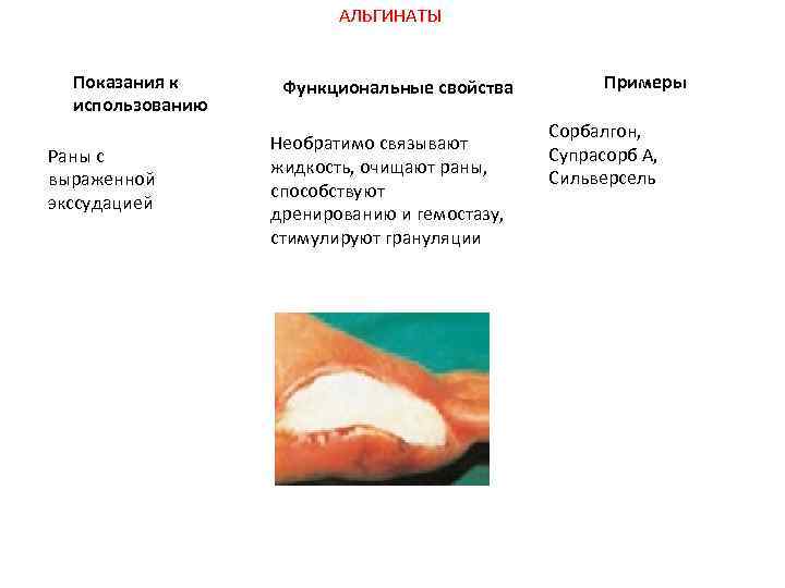 АЛЬГИНАТЫ Показания к использованию Раны с выраженной экссудацией Функциональные свойства Необратимо связывают жидкость, очищают