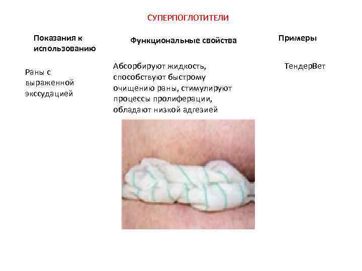 СУПЕРПОГЛОТИТЕЛИ Показания к использованию Раны с выраженной экссудацией Функциональные свойства Абсорбируют жидкость, способствуют быстрому