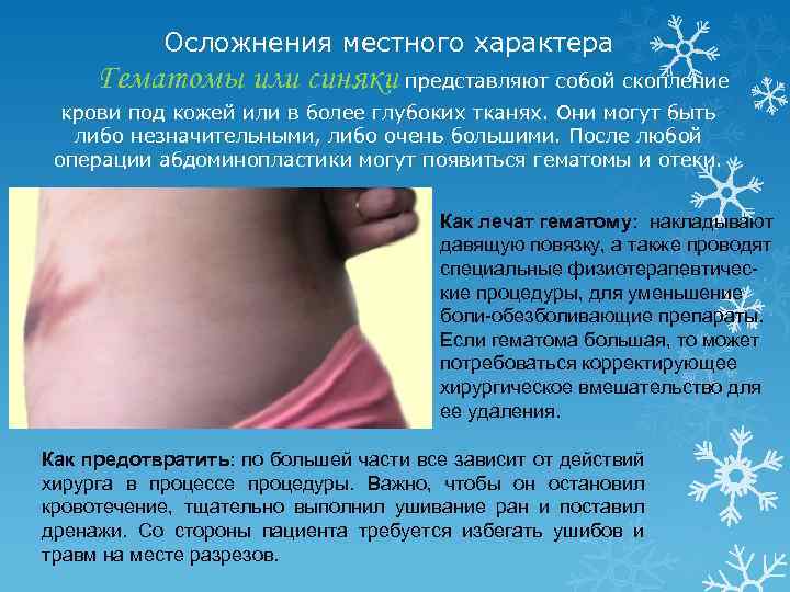 Осложнения местного характера Гематомы или синяки представляют собой скопление крови под кожей или в