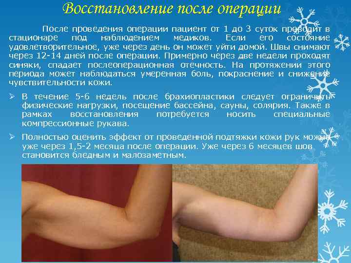 Восстановление после операции После проведения операции пациент от 1 до 3 суток проводит в