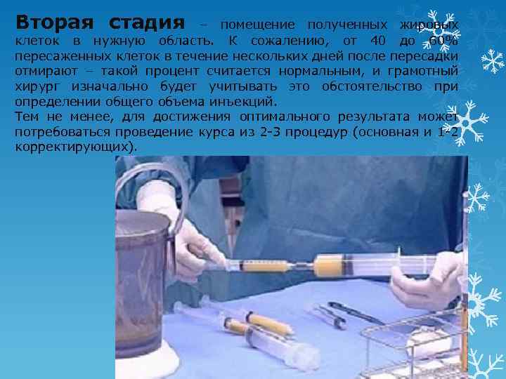 Вторая стадия – помещение полученных жировых клеток в нужную область. К сожалению, от 40