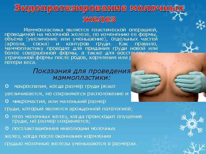 Эндопротезирование молочных желез Маммопластика является пластической операцией, проводимой на молочной железе, по изменению ее