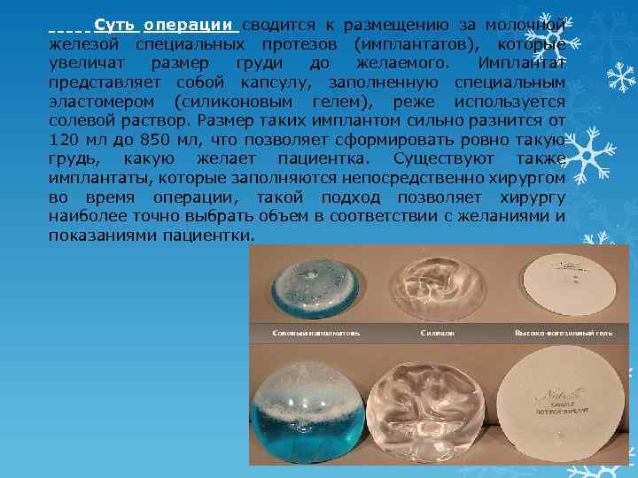 Суть операции сводится к размещению за молочной железой специальных протезов (имплантатов), которые увеличат размер