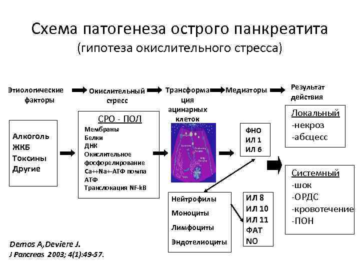 Схема патогенеза острого панкреатита (гипотеза окислительного стресса) Этиологические факторы Окислительный стресс СРО - ПОЛ