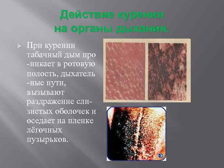 Действие курения на органы дыхания. Ø При курении табачный дым про -никает в ротовую