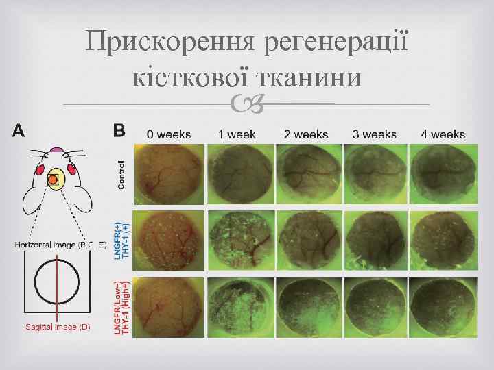 Прискорення регенерації кісткової тканини 