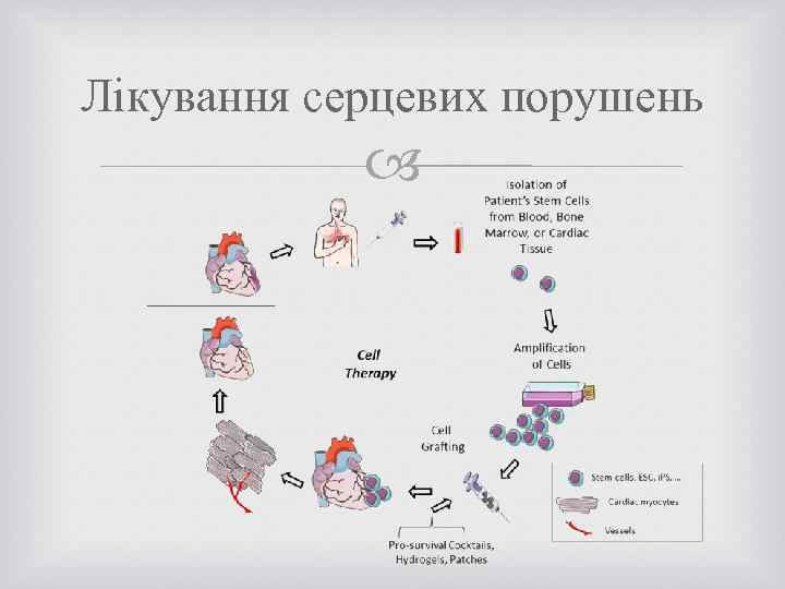 Лікування серцевих порушень 