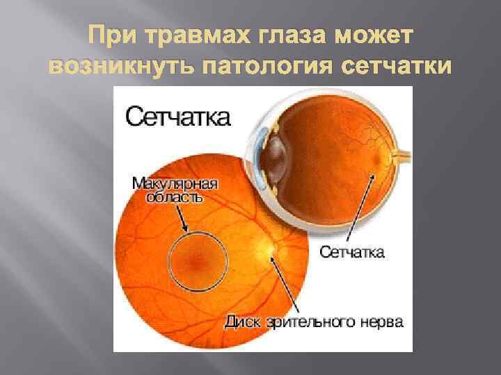 При травмах глаза может возникнуть патология сетчатки 