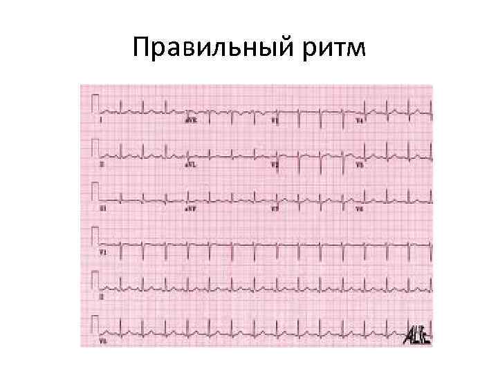 Правильный ритм 