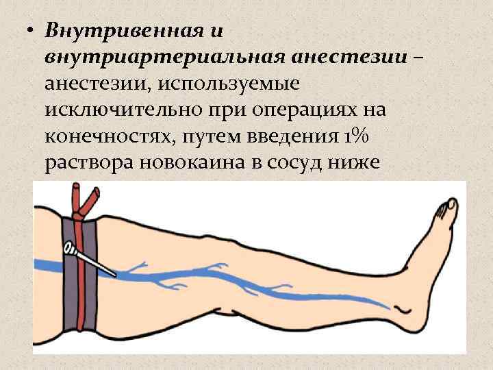 Первая помощь бедренной артерии