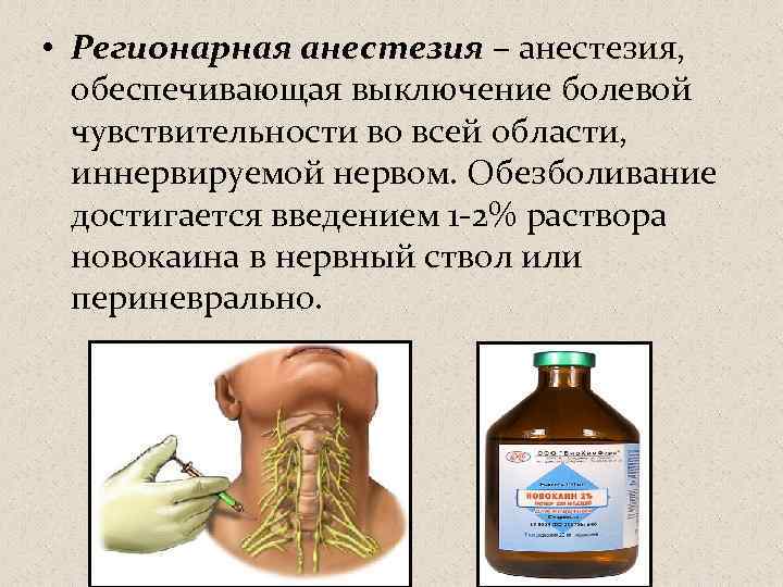  • Регионарная анестезия – анестезия, обеспечивающая выключение болевой чувствительности во всей области, иннервируемой