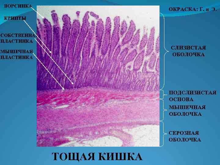 ВОРСИНКА ОКРАСКА: Г. и Э. КРИПТЫ СОБСТВЕННАЯ ПЛАСТИНКА СЛИЗИСТАЯ ОБОЛОЧКА МЫШЕЧНАЯ ПЛАСТИНКА ПОДСЛИЗИСТАЯ ОСНОВА