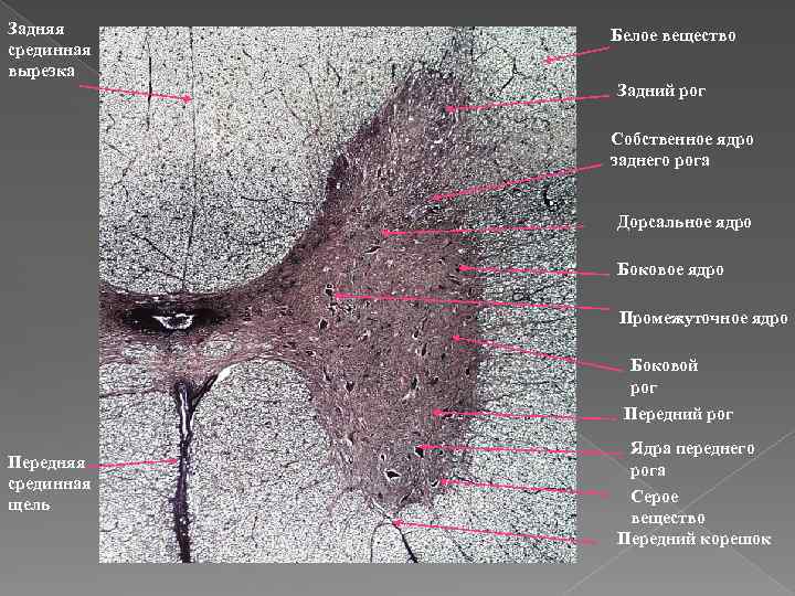 Задняя срединная вырезка Белое вещество Задний рог Собственное ядро заднего рога Дорсальное ядро Боковое