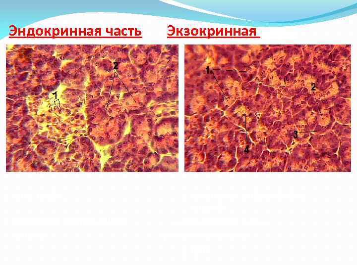 Эндокринная часть 1 -инсулоцит 2 -концевые секреторные отделы Экзокринная часть 1 -концевые секреторные отделы