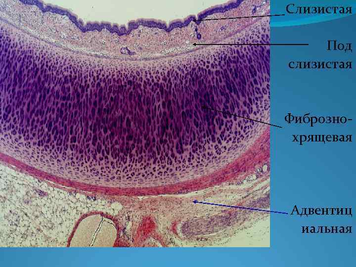 Слизистая Под слизистая Фибрознохрящевая Адвентиц иальная 