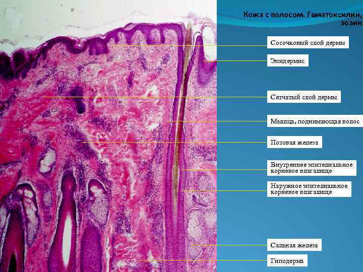 Кожа с волосом. Гематоксилин, эозин. Сосочковый слой дермы Эпидермис Сетчатый слой дермы Мышца, поднимающая