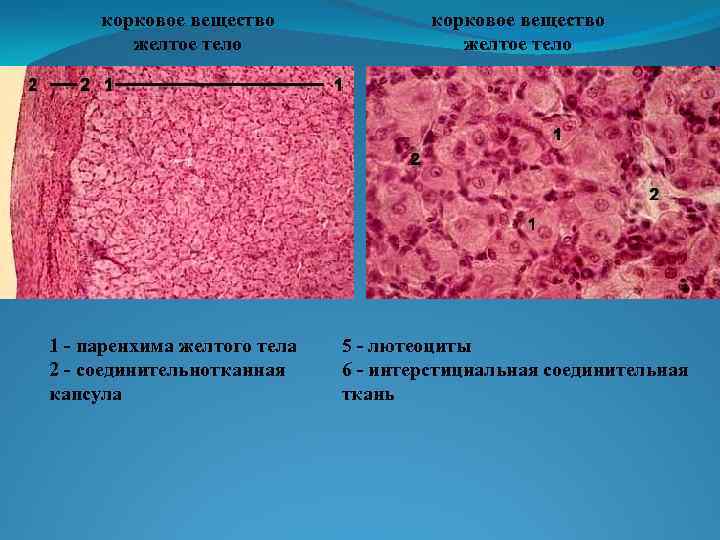 корковое вещество желтое тело 1 - паренхима желтого тела 2 - соединительнотканная капсула корковое