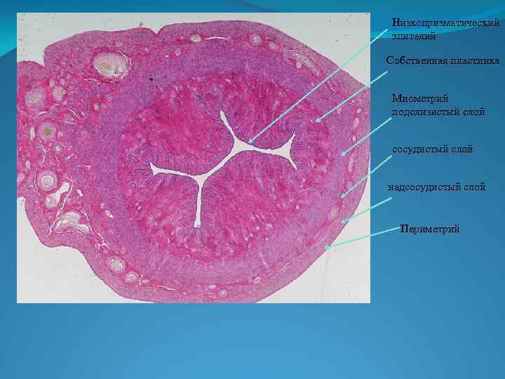 Низкопризматический эпителий Собственная пластинка Миометрий подслизистый слой сосудистый слой надсосудистый слой Периметрий 