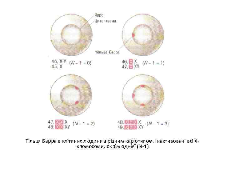 Тільця Барра в клітиних людини з різним каріотипом. Інактивовані всі Ххромосоми, окрім однієї (N-1)