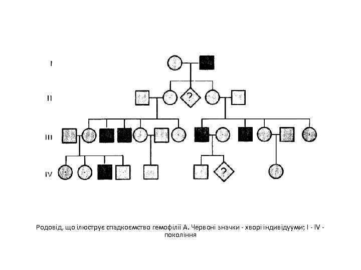 Родовід, що ілюструє спадкоємство гемофілії А. Червоні значки - хворі індивідууми; I - IV