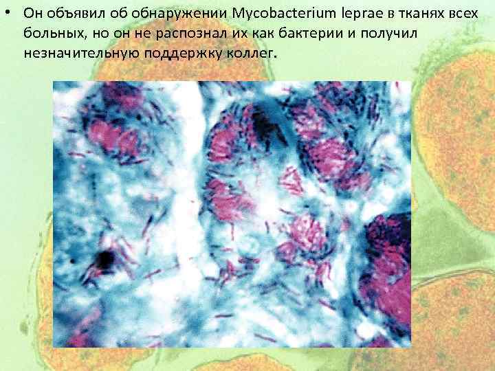  • Он объявил об обнаружении Mycobacterium leprae в тканях всех больных, но он