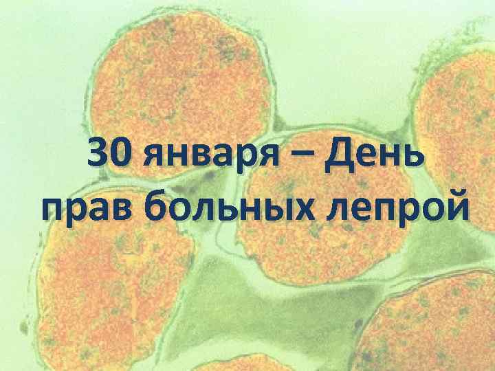 30 января – День прав больных лепрой 