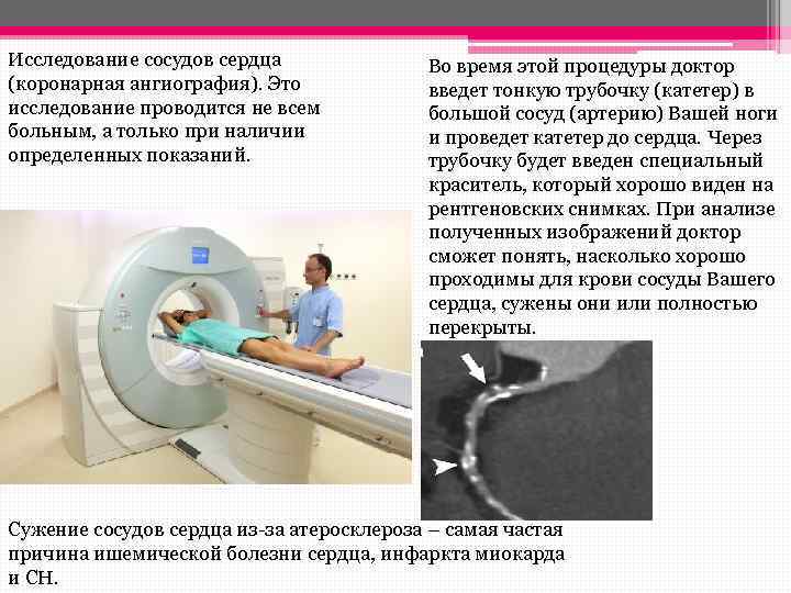 Сосудистые исследования. Исследование сосудов. Ангиография принцип метода. Порядок проведения ангиографии. Ангиография это метод обследования.