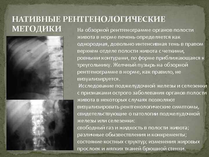 НАТИВНЫЕ РЕНТГЕНОЛОГИЧЕСКИЕ МЕТОДИКИ На обзорной рентгенограмме органов полости живота в норме печень определяется как