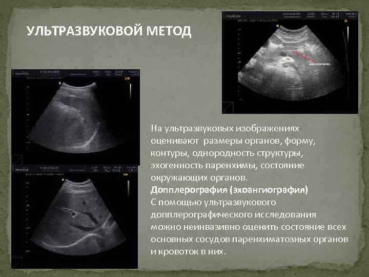 УЛЬТРАЗВУКОВОЙ МЕТОД На ультразвуковых изображениях оценивают размеры органов, форму, контуры, однородность структуры, эхогенность паренхимы,