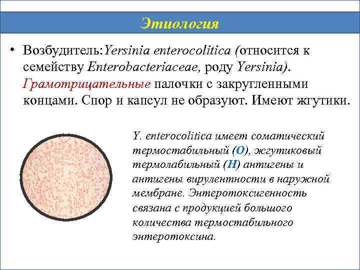 Этиология • Возбудитель: Yersinia enterocolitica (относится к семейству Enterobacteriaceae, роду Yersinia). Грамотрицательные палочки с