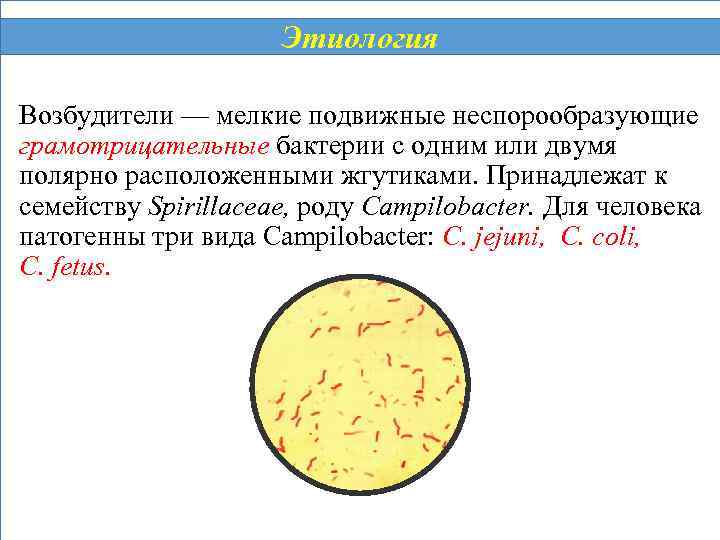 Этиология Возбудители — мелкие подвижные неспорообразующие грамотрицательные бактерии с одним или двумя полярно расположенными