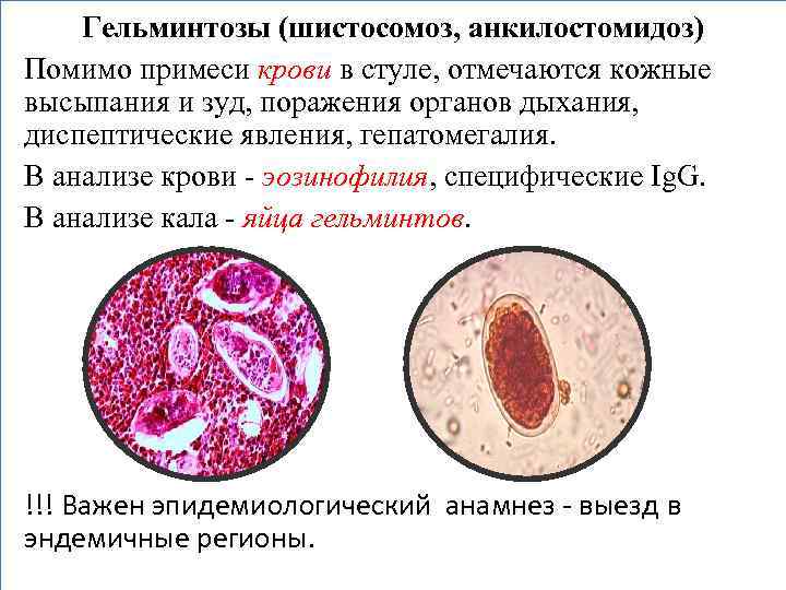 Гельминтозы (шистосомоз, анкилостомидоз) Помимо примеси крови в стуле, отмечаются кожные высыпания и зуд, поражения