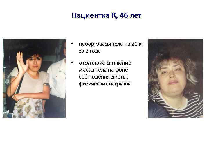 Пациентка К, 46 лет • набор массы тела на 20 кг за 2 года