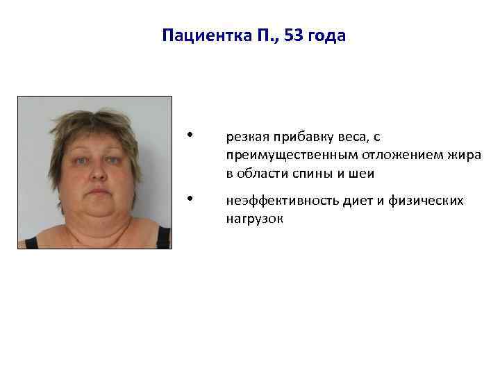 Пациентка П. , 53 года • резкая прибавку веса, с преимущественным отложением жира в