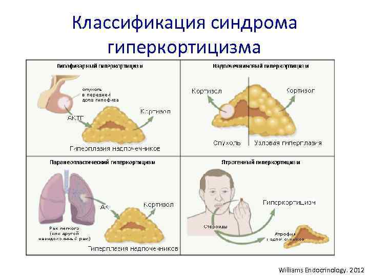 Патогенез гиперкортицизма схема