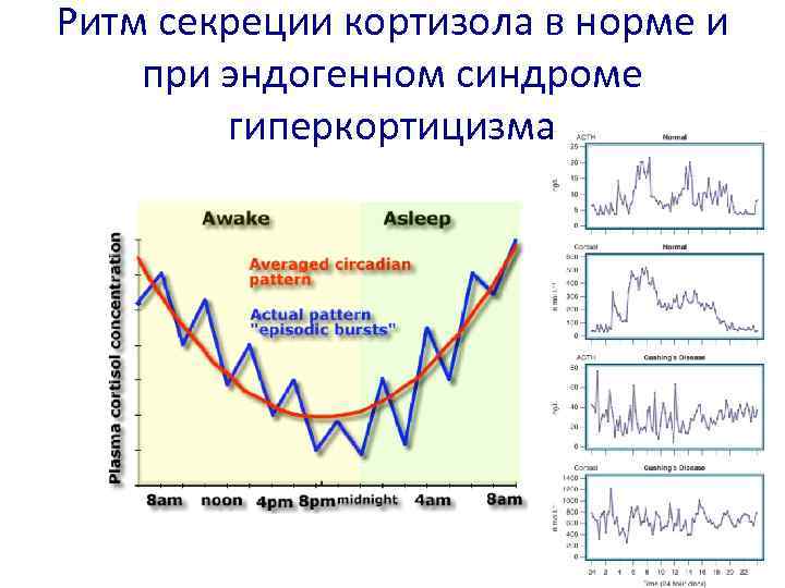 Ритм секреции кортизола в норме и при эндогенном синдроме гиперкортицизма 