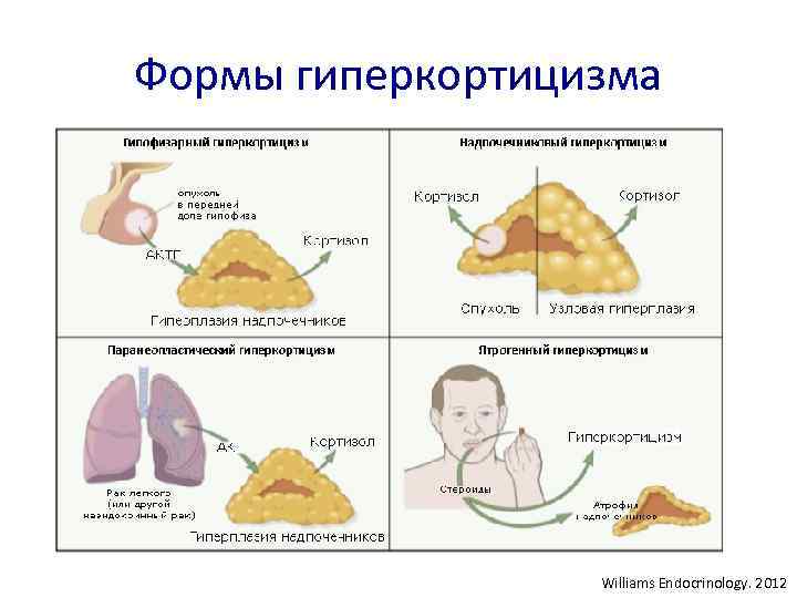 Формы гиперкортицизма Williams Endocrinology. 2012 