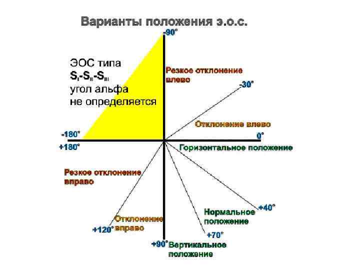 Схема дьеда для экг