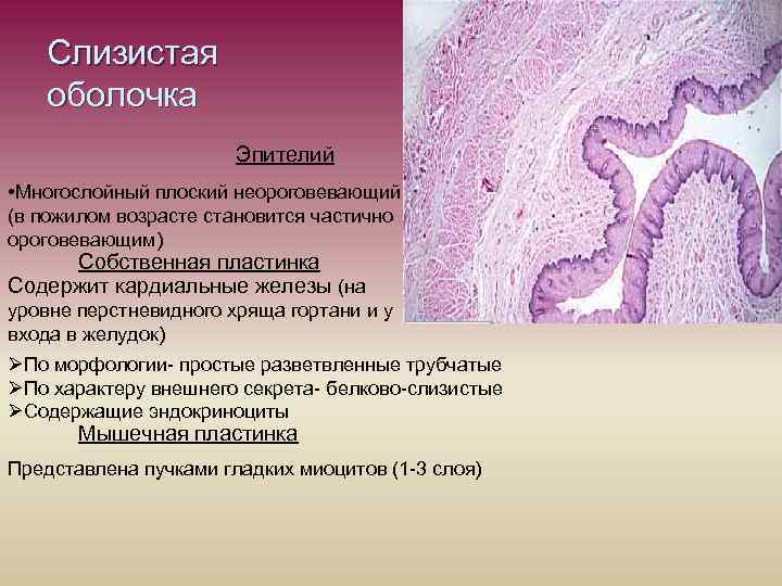 Слизистая оболочка Эпителий • Многослойный плоский неороговевающий (в пожилом возрасте становится частично ороговевающим) Собственная