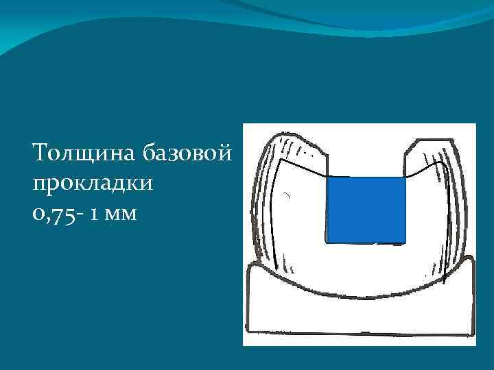 Толщина базовой прокладки 0, 75 - 1 мм 