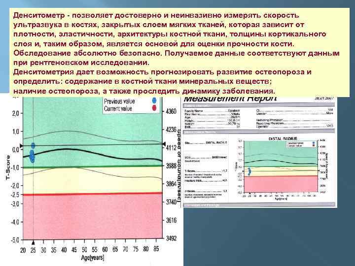 Денситометр - позволяет достоверно и неинвазивно измерять скорость ультразвука в костях, закрытых слоем мягких