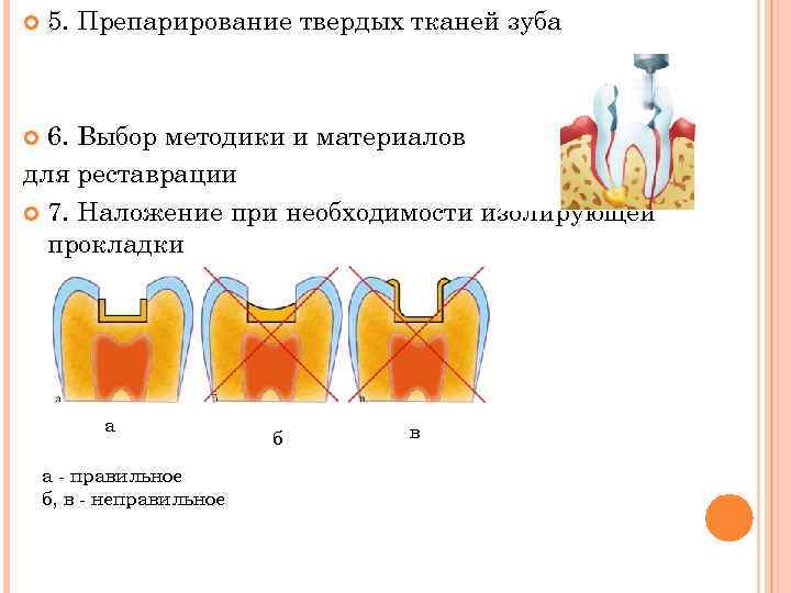 Препарирование зуба. Препарирование твердых тканей зуба. Принципы препарирования твердых тканей зуба. Пневматический метод препарирования твердых тканей зубов. Методы препарирования твердых тканей зубов таблица.