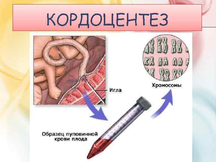 КОРДОЦЕНТЕЗ 