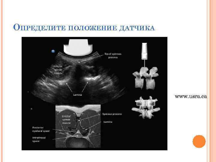 ОПРЕДЕЛИТЕ ПОЛОЖЕНИЕ ДАТЧИКА www. usra. ca 