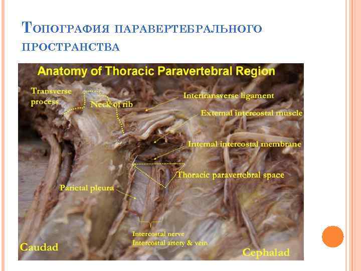 ТОПОГРАФИЯ ПАРАВЕРТЕБРАЛЬНОГО ПРОСТРАНСТВА 