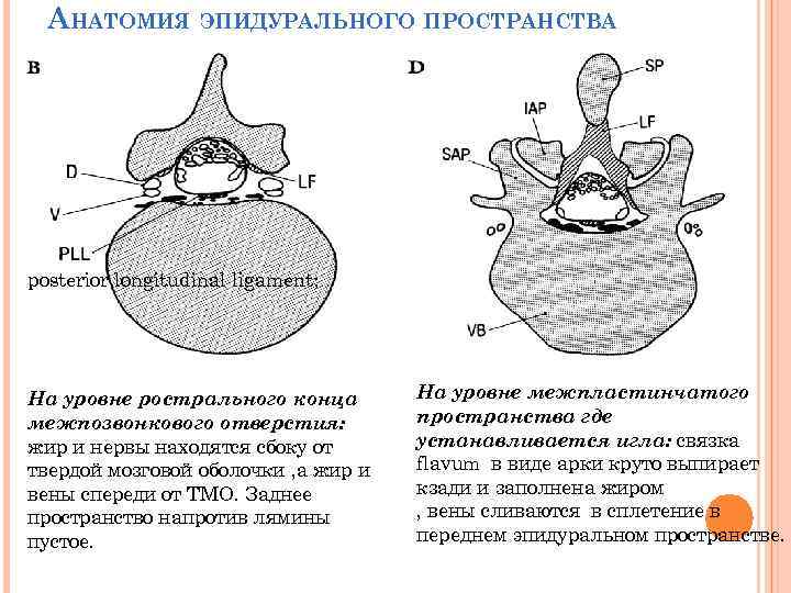 АНАТОМИЯ ЭПИДУРАЛЬНОГО ПРОСТРАНСТВА posterior longitudinal ligament; На уровне рострального конца межпозвонкового отверстия: жир и