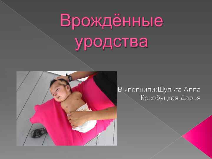 Врождённые уродства Выполнили: Шульга Алла Кособуцкая Дарья 