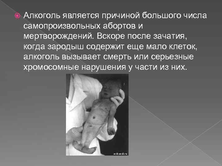  Алкоголь является причиной большого числа самопроизвольных абортов и мертворождений. Вскоре после зачатия, когда